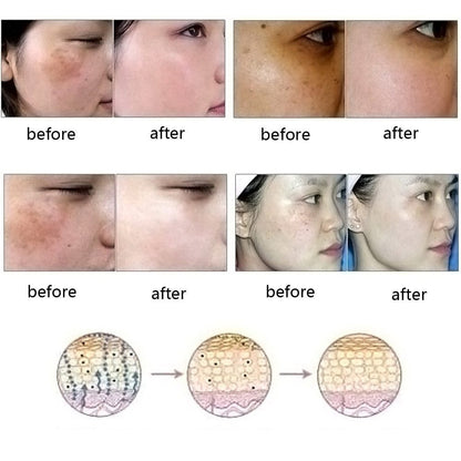 "Dredge Meridian Essence Oil
