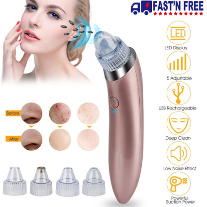 Electric Blackhead Remover Vacuum Suction Facial Pore Cleaner Acne Pimple Extractor Skin Care Cleaning Tool with 4 Suction Head